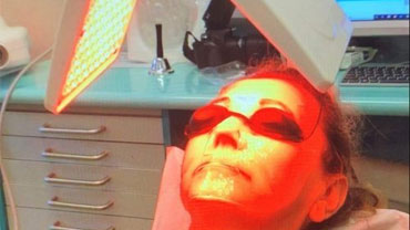 Facial rejuvenation
